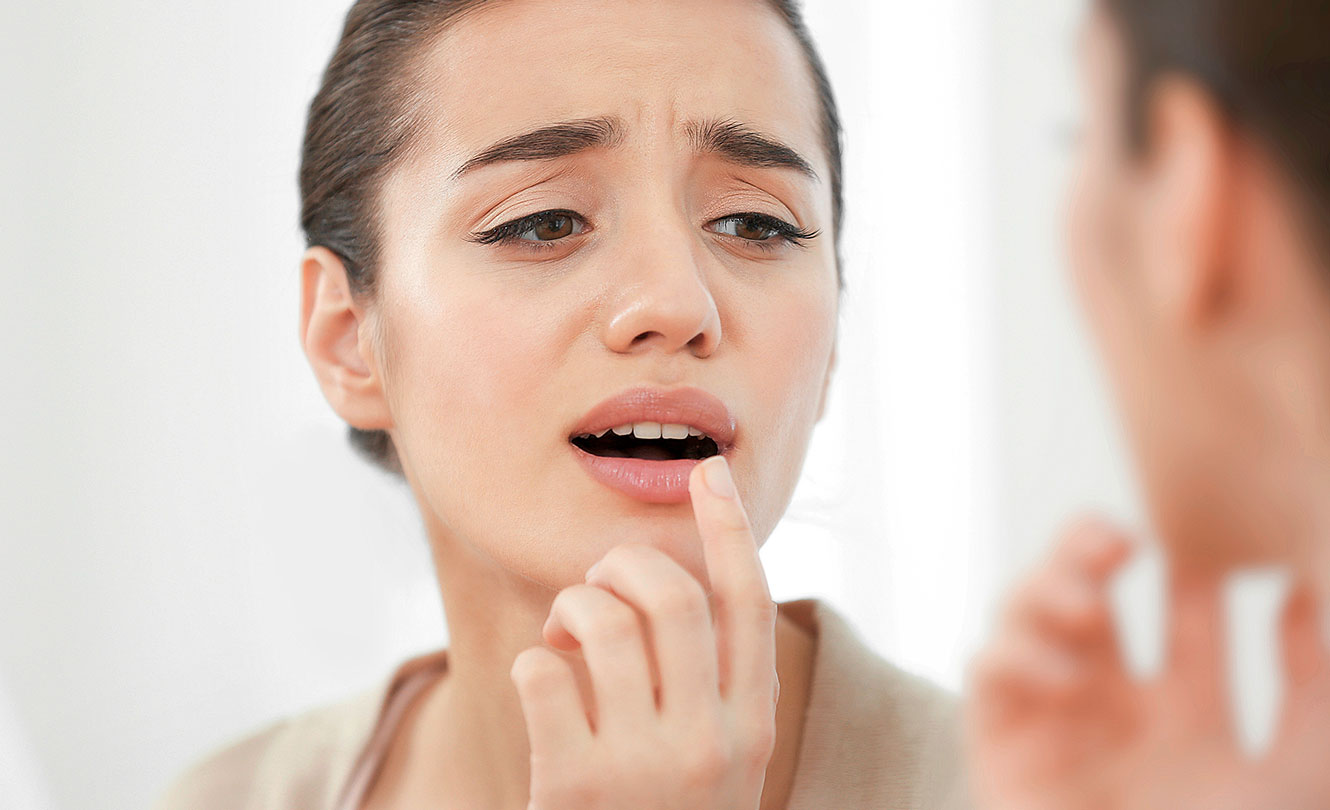 Fieberbläschen innert Stunden behandeln! – GlücksPost